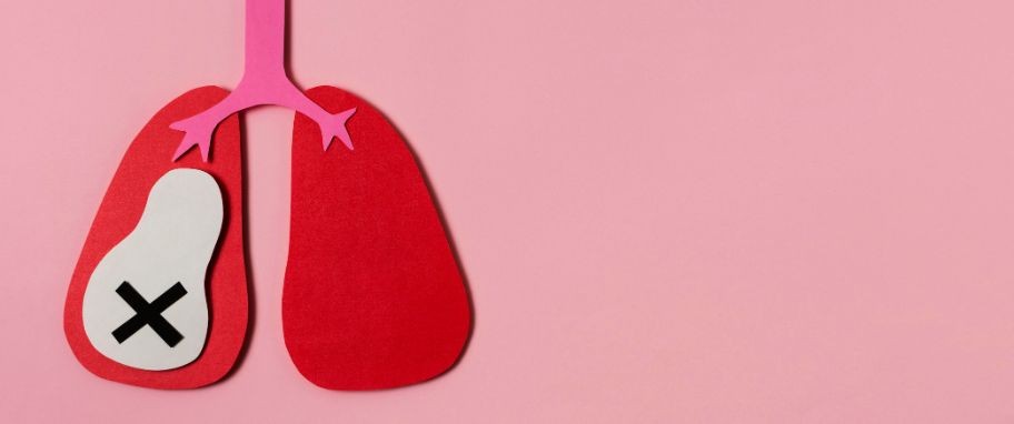 Arykuł banner - Zatorowość płucna - przyczyny, objawy i leczenie. Jakie są czynniki ryzyka zatoru płucnego? Czym zator r&oacute;żni się od zakrzepicy?