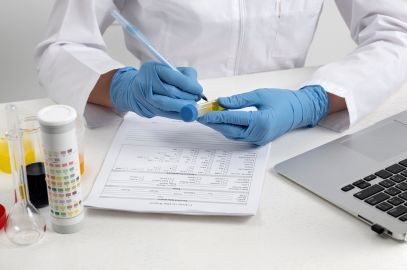 Zdjęcie artykułu - GGTP (gamma-glutamylotranspeptydaza) - czym jest, wskazania do badania GGTP. O czym może świadczyć podwyżone GGTP? Podwyższone GGTP a alkohol. Panel badań wątroby: poziom GGTP, ALT, AST