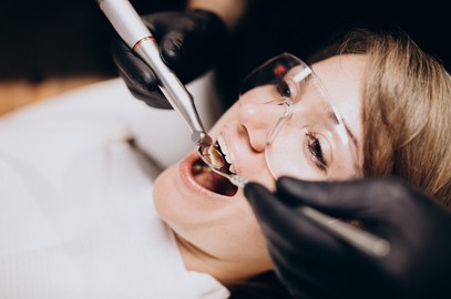 Zdjęcie artykułu - Korona, most, implant zębowy - rodzaje i charakterystyka metod odbudowy zęba. Sposoby uzupełnień zęba.
