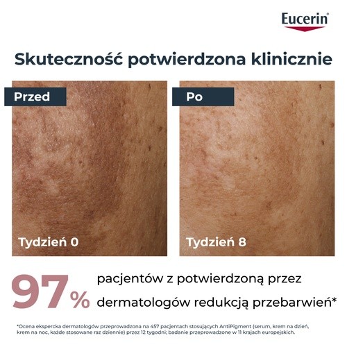 Zdjęcie produktu - 2 Eucerin Anti-Pigment Krem na dzień przeciw przebarwieniom SPF30, 50 ml