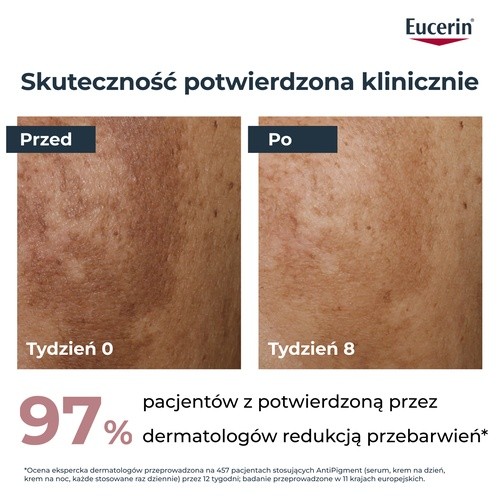 Miniaturka artykułu - #1 Eucerin Anti-Pigment Serum przeciw przebarwieniom o podw&oacute;jnym działaniu, 30 ml