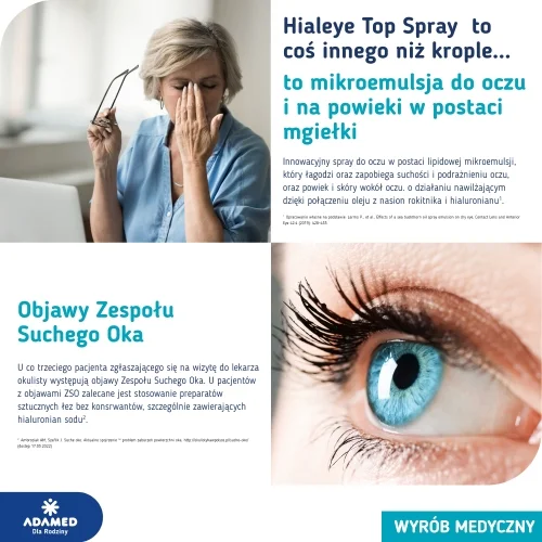 #3 – Hialeye Top spray na suchość oka, 17 ml