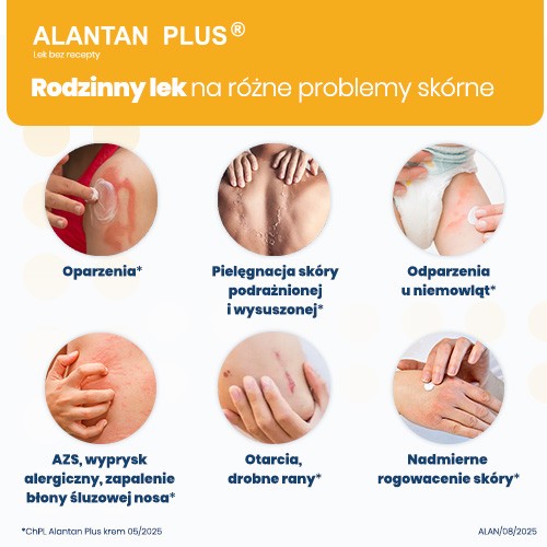 Miniaturka artykułu - #1 ALANTAN PLUS Krem, 100 g