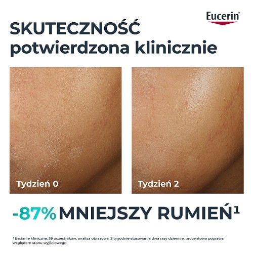Miniaturka artykułu - #1 Eucerin DermoPure Clinical Hydra Repair Krem kojący, 40 ml