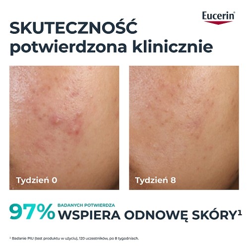 Miniaturka artykułu - #0 Eucerin DermoPure Clinical Kuracja złuszczająco-wygładzająca Kwasowy peeling na noc, 40 ml