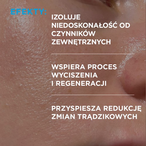 Miniaturka artykułu - #1 Idee Derm Żel punktowy na wypryski, 15 ml