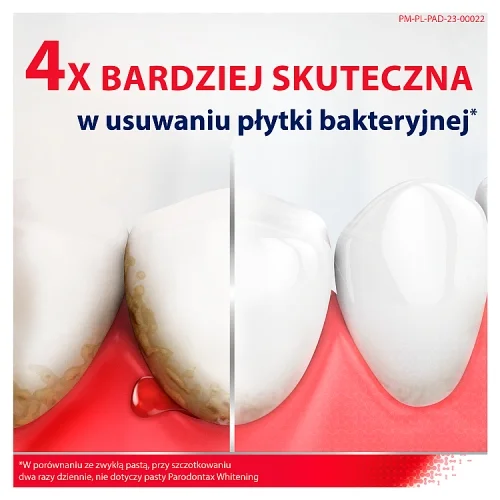 #0 – Parodontax Whitening Pasta do zęb&oacute;w wybielająca na krwawiące dziąsła, 75 ml
