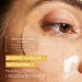 Zdjęcie produktu - #0 L'BIOTICA PHF + Witamina C Nawilżenie & Rozświetlenie Hydrożelowe Płatki pod oczy, 2 sztuki