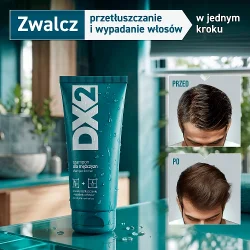 Miniaturka artykułu - #0 DX2 Szampon dla mężczyzn przeciw przetłuszczaniu i wypadaniu włos&oacute;w, 150ml